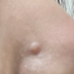 나 코에 이딴<b>거남</b> 미치겟어