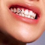 [NCT칠프] 나비를 이까지 <b>박아</b>넣을 줄야