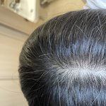 30대 초인데 <b>흰머리</b>
