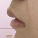 턱이랑 입술라인 이따<b>구면</b> 뭐 어케해야함