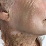 40년동안 얼굴에만 선크림 바르면 생기는 일