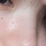 나 코 살빼면 <b>얄쌍</b>해지려나?