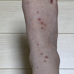 [댓글부탁해] 얘드라 이거 뭔 <b>상처</b>같음?