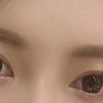 쌍수한눈같나요?