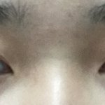 [19] 이정도면 <b>복코</b> 가망 없는거임?