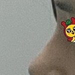 코성형 <b>전후</b>