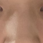 [댓글부탁해] 이런코 <b>쉐딩</b> 어케해야해? 성형이 답임?
