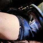 [군대] 허벅지 이게 <b>흉터</b>라고?