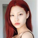 턱보톡스 맞고 옴~!~
