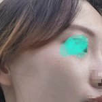 [댓글부탁해] 너네가 내 상황이면 성형해??