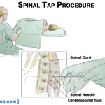 암환자 올케 검사받고 왔는데 술 <b>사오</b>라는 시누