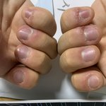 혐주의) 손톱 이런데 네일<b>케어</b> 받을 수 있음?