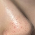 내 블랙<b>헤드</b> 우짜노..