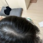 [드루와] 얘들아 나 <b>탈모</b> 맞지ㅅ부ㅜ