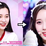 연예인들 <b>치아</b>교정기 착용 전후 모습