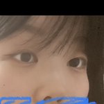 [드루와] <b>빛삭</b>)얘들아 나 코 성형하면 얼굴ㅜㅜ