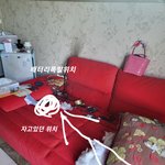 [방탈죄송] (추가글) <사진주의> 배터리폭발 사고로 화상을 입었습니다...