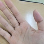 [그냥궁금] 여러분 이거 <b>각질</b>인가요?