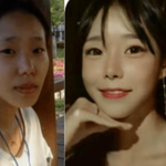 <b>이은해</b> 성형전후