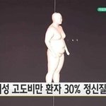 [댓글부탁해] 고도비만 <b>정신질</b>환자