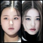 [드루와] 장원영 <b>입술</b>필러