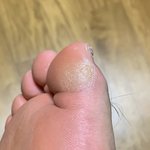 혐주이!! 아기판남 발 이고 <b>어떠</b>케??