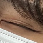[댓글부탁해] 원래 쌍수하면 <b>윙크</b>할때 이케됨?