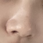 <b>진지</b>하게 코 수술할까?