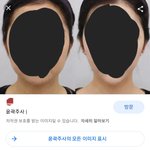 윤곽<b>주사</b>로 이게 돼??