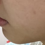 얘들아 나 이거 <b>돌출</b>입임..?