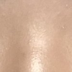 [19] <b>쌍수</b> <b>티</b> 나?