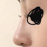 [댓글부탁해] 너희 내 <b>코</b>면 수술함 ?