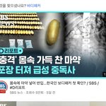 아니 몸에 이걸 대체 어케 넣는거임?