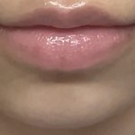 나 입술<b>필러</b> 어케 생각함?? ㅈㄴ 진지