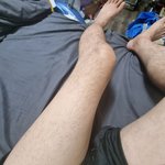 의료사고로 힘듭니다