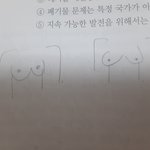가슴 <b>모양</b> 이거 정상임??