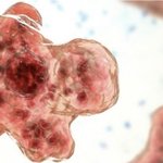 '뇌 먹는 아메바'에 10대 사망