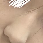 내 코 <b>보정</b> 어떰 ㅋㅅㅋ