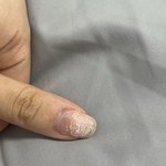 [댓글부탁해] 손톱 <b>단단</b>해지는 법 아는자람 제발