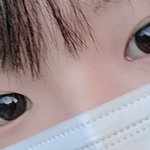 <b>쌍수앞트임</b> 괜찮게 될까..?