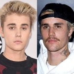 백인들 노화  속도 체감