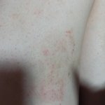 [댓글부탁해] <b>다리</b>에 이거 낫지를 않는데 뭐인 거 같아? (<b>다리</b><b>사진</b>주의)