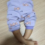 [이것좀봐줘] 희귀병 XLH 치료제가 국회 청원에 올라왔습니다....