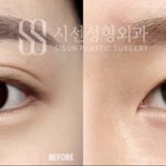 이거 <b>쏘세지</b>눈임?