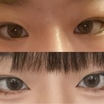 [댓글부탁해] ++추가)쌍수하는 게 나을까
