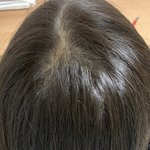 가르마(정수리)<b>탈모</b> 같아보여?ㅠㅠ