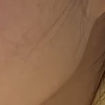 <b>사각</b>턱 보톡스 잘 아는애들아