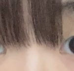 쌍수할까 말까 봐줘