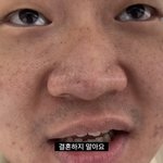 혁이오빠 피부 실화냐