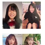 성형에 1억 썼다는 일본 여성